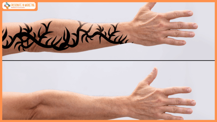 The Ultimate Guide to How Long Tattoo Removal Takes