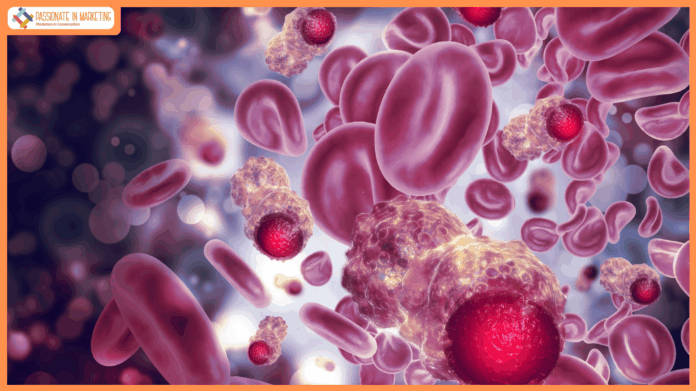 Multiple Myeloma Accounts for 10% of Blood Cancers—But Timely, Targeted Therapy Can Lead to Remission