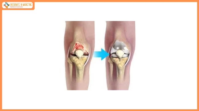 Advanced Orthopedic Care Reaches Gadchiroli as Lloyds Hospital Completes First Knee Replacement Surgery
