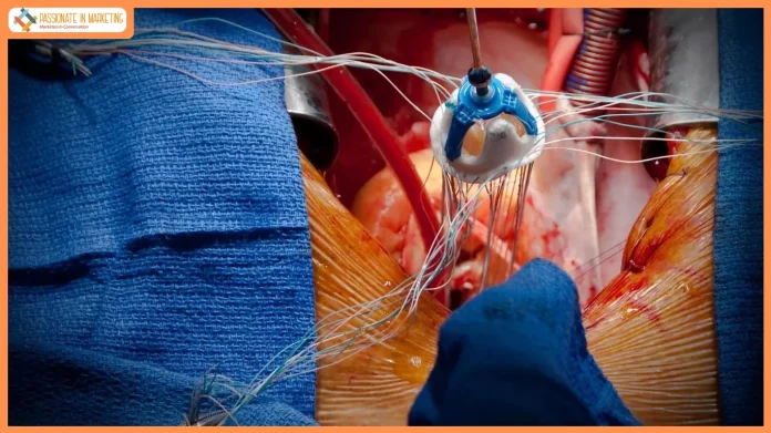 Apollo Performs Rare Zero-Contrast Heart Valve Procedure, Saving Kidney Transplant Recipient Once Considered Untreatable